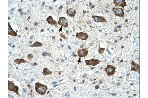 Image no. 1 for anti-Kv Channel Interacting Protein 2 (KCNIP2) (AA 22-71) antibody (ABIN6735459) (KCNIP2 抗体  (AA 22-71))