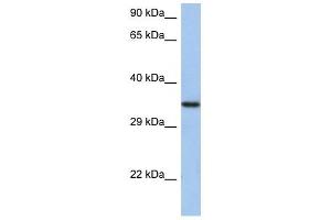 HORMAD2 antibody used at 1 ug/ml to detect target protein. (HORMAD2 抗体  (N-Term))
