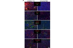 Immunofluorescence (Paraffin-embedded Sections) (IF (p)) image for anti-Chemokine (C-X-C Motif) Receptor 1 (CXCR1) (C-Term) antibody (ABIN2854740)