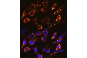 Immunofluorescence analysis of NIH-3T3 cells using SFRP4 Rabbit mAb (ABIN7270180) at dilution of 1:100 (40x lens). (SFRP4 抗体)