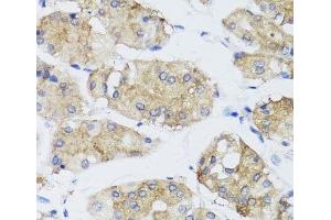 Immunohistochemistry of paraffin-embedded Human stomach using FGF13 Polyclonal Antibody at dilution of 1:100 (40x lens). (FGF13 抗体)