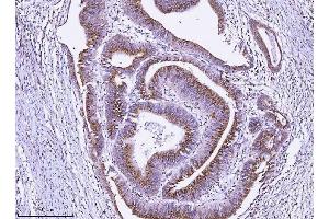 IHC analysis of ALDH3A1 using anti-ALDH3A1 antibody (ABIN7602181).