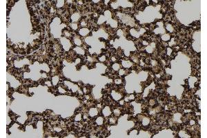 ABIN6273268 at 1/100 staining Mouse lung tissue by IHC-P. (MRFAP1 抗体  (Internal Region))