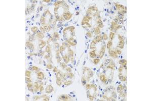 Immunohistochemistry of paraffin-embedded human stomach using MIP antibody (ABIN5971491) at dilution of 1/100 (40x lens). (MIP 抗体)