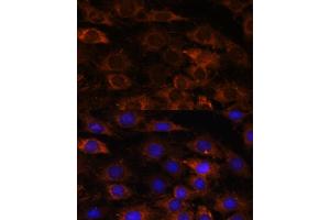 Immunofluorescence (IF) image for anti-Heme Binding Protein 2 (HEBP2) (AA 1-205) antibody (ABIN7267604)
