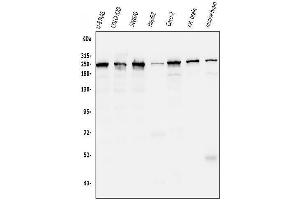 Western blot analysis of Ch TOG/CKAP5 using anti-Ch TOG/CKAP5 antibody (ABIN7599106).