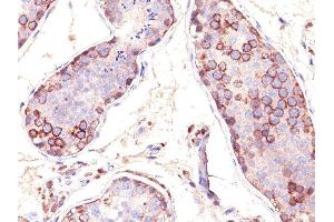 Formalin-fixed, paraffin-embedded human Testis stained with MAGE-1 Monoclonal Antibody (SPM282). (MAGEA1 抗体)