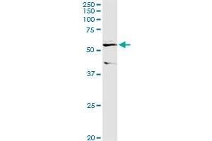 ALDH3B1 MaxPab rabbit polyclonal antibody. (ALDH3B1 抗体  (AA 1-431))