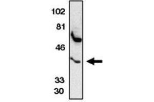 Image no. 1 for anti-Chemokine (C-C Motif) Receptor 5 (CCR5) (AA 6-20) antibody (ABIN265000) (CCR5 抗体  (AA 6-20))