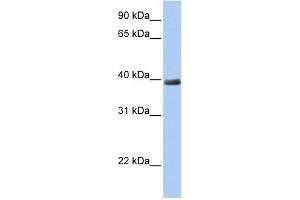WB Suggested Anti-ZNF391 Antibody Titration:  0. (ZNF391 抗体  (N-Term))