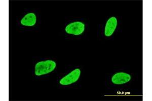 Immunofluorescence of monoclonal antibody to SGK1 on HeLa cell. (SGK1 抗体  (AA 1-90))