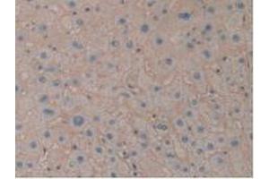 IHC-P analysis of Human Liver Tissue, with DAB staining. (ENPEP 抗体  (AA 718-948))