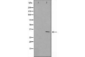 Western blot analysis on COLO205 cell lysate using RNF144A Antibody，The lane on the left is treated with the antigen-specific peptide. (RNF144A 抗体  (Internal Region))