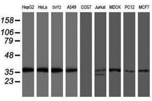 Image no. 1 for anti-O-Sialoglycoprotein Endopeptidase (OSGEP) (AA 1-335) antibody (ABIN1490751) (OSGEP 抗体  (AA 1-335))