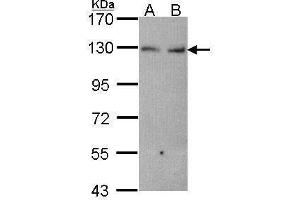 WB Image Sample (30 ug of whole cell lysate) A: Hela B: JurKat 7. (CDH6 抗体)