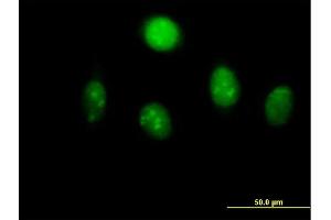 Immunofluorescence of  purified  MaxPab antibody to MYST2 on HeLa cell. (MYST2 抗体  (AA 1-611))