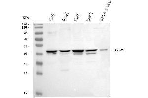 anti-Absent in Melanoma 2 (AIM2) (AA 14-215) antibody