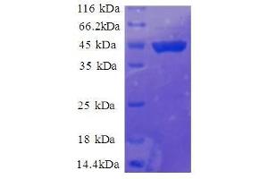 Ribosomal Protein S11 (RPS11) (AA 2-158), (full length) protein (GST tag) (RPS11 Protein (AA 2-158, full length) (GST tag))