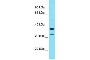 Host: Rabbit Target Name: CENPVP1 Sample Type: Fetal Liver lysates Antibody Dilution: 1.