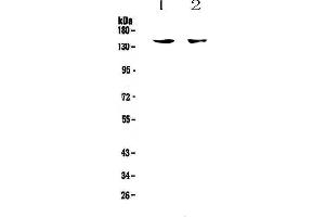 Western Blotting (WB) image for anti-Integrin, alpha X (Complement Component 3 Receptor 4 Subunit) (ITGAX) (AA 161-342) antibody (ABIN5693169)