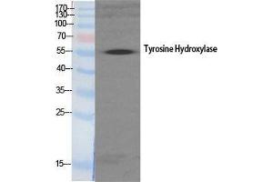 Western Blot (WB) analysis of specific cells using TH Polyclonal Antibody. (TH 抗体  (Tyr161))
