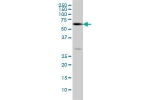 OXSR1 monoclonal antibody (M09), clone 5D5 Western Blot analysis of OXSR1 expression in HeLa . (OXSR1 抗体  (AA 351-450))