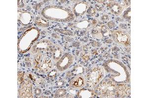 ABIN6266800 at 1/100 staining human kidney tissue sections by IHC-P. (MAP3K6 抗体  (C-Term))