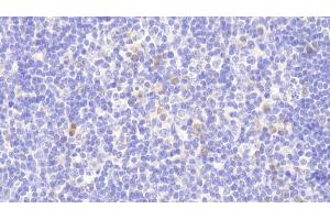 Detection of PARP4 in Human Lymph node Tissue using Polyclonal Antibody to Poly ADP Ribose Polymerase 4 (PARP4) (PARP4 抗体  (AA 338-609))