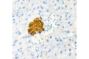 Immunohistochemistry (Paraffin-embedded Sections) (IHC (p)) image for anti-Mucosal Vascular Addressin Cell Adhesion Molecule 1 (MADCAM1) antibody (ABIN7074695)