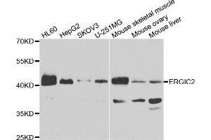 Western blot analysis of extracts of various cell lines, using ERGIC2 antibody. (ERGIC2 抗体)