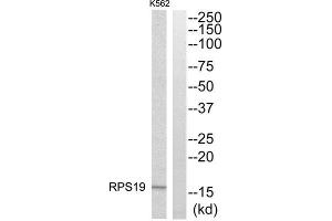 Western Blotting (WB) image for anti-Ribosomal Protein S19 (RPS19) (Internal Region) antibody (ABIN1850576) (RPS19 抗体  (Internal Region))