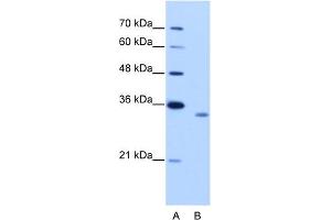 WB Suggested Anti-RBM4B Antibody Titration:  2. (RBM4B 抗体  (C-Term))