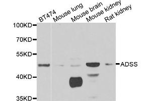 Western blot analysis of extracts of various cell lines, using ADSS antibody (ABIN5973901) at 1/1000 dilution. (ADSS 抗体)