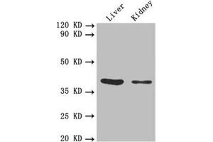 Western blot All lanes: FCGRT antibody at 5. (FcRn 抗体  (AA 24-297))
