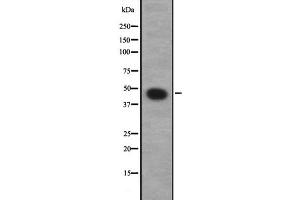 Western blot analysis of GNA12 expression in NT2D1 whole cell lysate,The lane on the left is treated with the antigen-specific peptide.