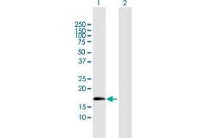 Western Blot analysis of ZNF280D expression in transfected 293T cell line by ZNF280D MaxPab polyclonal antibody. (ZNF280D 抗体  (AA 1-158))