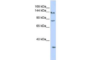 WB Suggested Anti-SIN3A Antibody Titration:  0. (SIN3A 抗体  (N-Term))