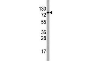 Western blot analysis of EIF4B antibody antibody and HepG2 lysate. (EIF4B 抗体  (AA 353-382))