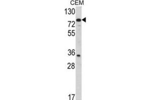 Western Blotting (WB) image for anti-Transglutaminase 4 (Prostate) (TGM4) antibody (ABIN5022825) (TGM4 抗体)
