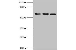 Western blot All lanes: ABCE1 antibody at 4 μg/mL Lane 1: 293T whole cell lysate Lane 2: Hela whole cell lysate Lane 3: k562 whole cell lysate Secondary Goat polyclonal to rabbit IgG at 1/10000 dilution Predicted band size: 67 kDa Observed band size: 67 kDa (ABCE1 抗体  (AA 320-599))