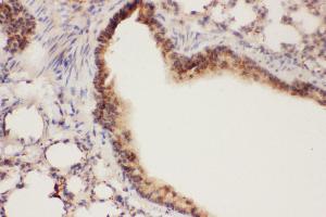 Anti-ALOX15 Picoband antibody,  IHC(P): Mouse Lung Tissue (ALOX15 抗体  (AA 2-337))