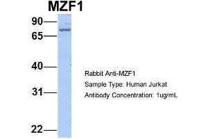 Host: Rabbit Target Name: MZF1 Sample Type: Jurkat Antibody Dilution: 1. (MZF1 抗体  (N-Term))