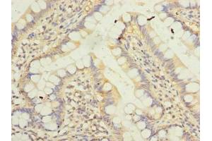 Immunohistochemistry of paraffin-embedded human small intestine tissue using ABIN7157240 at dilution of 1:100 (KLHDC8A 抗体  (AA 1-350))