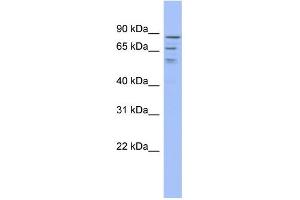 WB Suggested Anti-C1orf25 Antibody Titration:  0. (TRMT1L 抗体  (Middle Region))