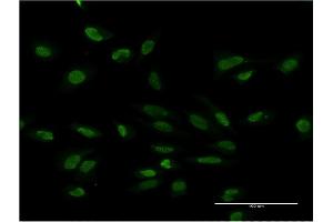 Immunofluorescence of monoclonal antibody to PMS2 on HeLa cell. (PMS2 抗体  (AA 763-862))