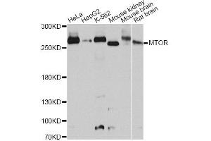 Western blot analysis of extracts of various cell lines, using MTOR antibody. (MTOR 抗体)