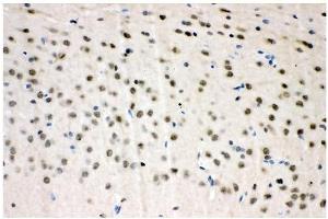 IHC analysis of VCP using anti-VCP antibody (ABIN3043958).