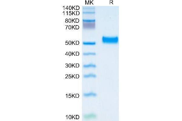 PEDF Protein (AA 20-418) (His tag)