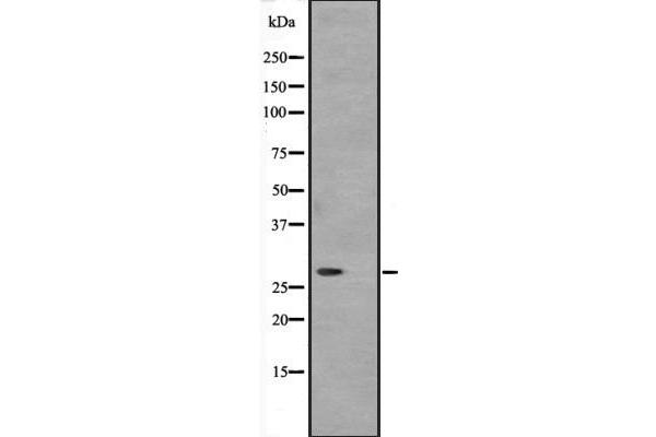 ATP6V1D 抗体  (Internal Region)