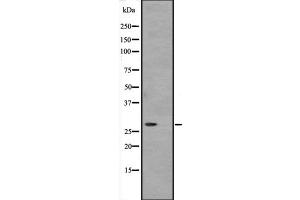 Western blot analysis of ATP6V1D expression in Hela cell lysate,The lane on the left is treated with the antigen-specific peptide. (ATP6V1D 抗体  (Internal Region))